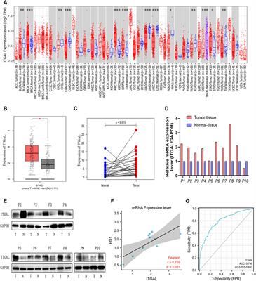 ITGAL as a Prognostic Biomarker Correlated With Immune Infiltrates in Gastric Cancer